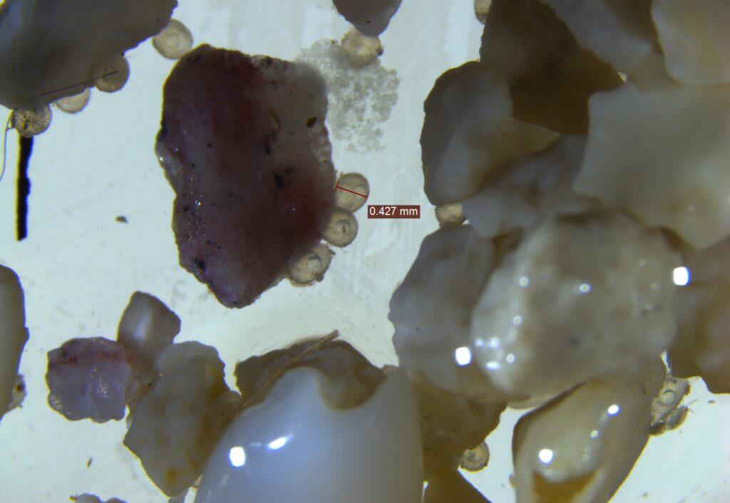 Under magnification, the eggs of Chromis cyanea, attached to grains of substrate, are easily seen.